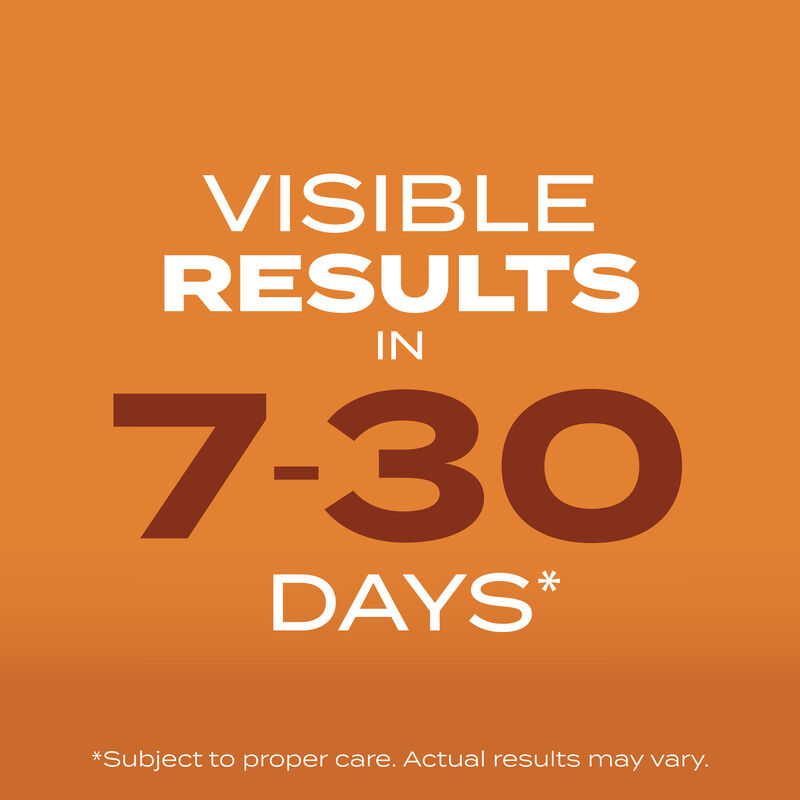 Scotts&reg; Turf Builder&reg; Grass Seed Bermudagrass image number null