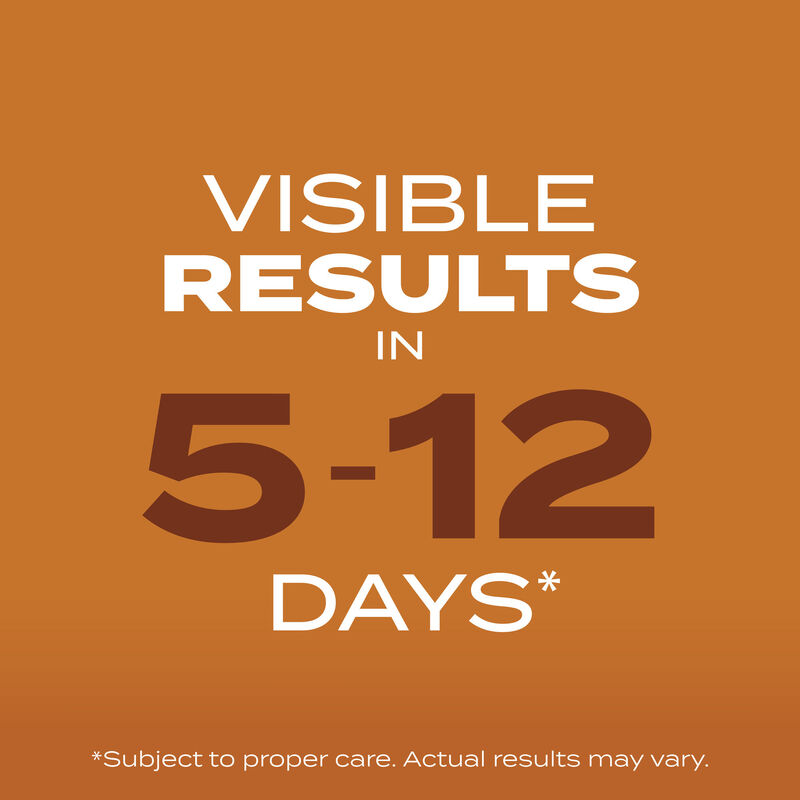 Scotts&reg; Turf Builder&reg; Grass Seed High Traffic Mix image number null